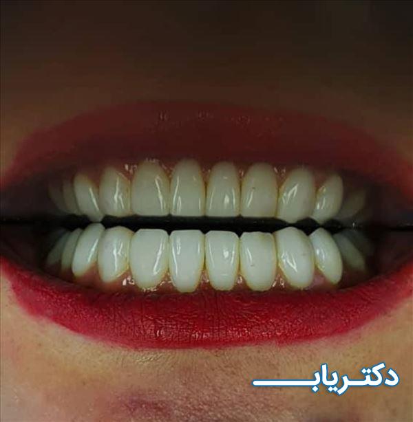 نمونه کار دکتر محمد الیاسی 5