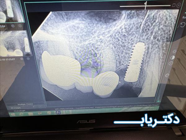 نمونه کار دکتر علیرضا اسحاقی