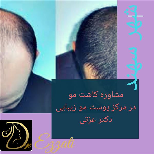 نمونه کار دکتر وحید عزتی