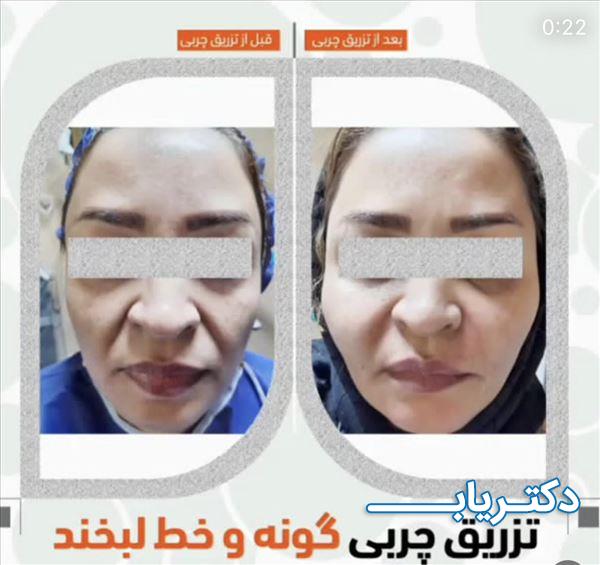نمونه کار دکتر جمال الدین حسن زاده 3