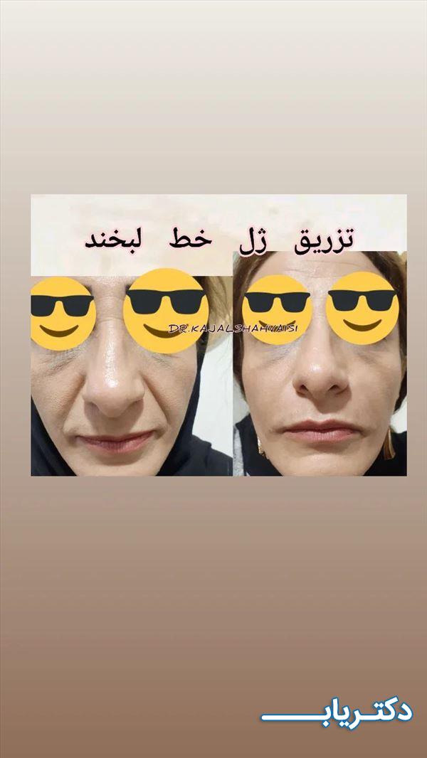 نمونه کار دکتر کژال شاه ویسی