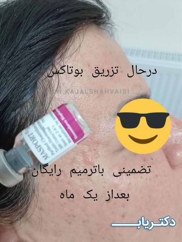 نمونه کار دکتر کژال شاه ویسی