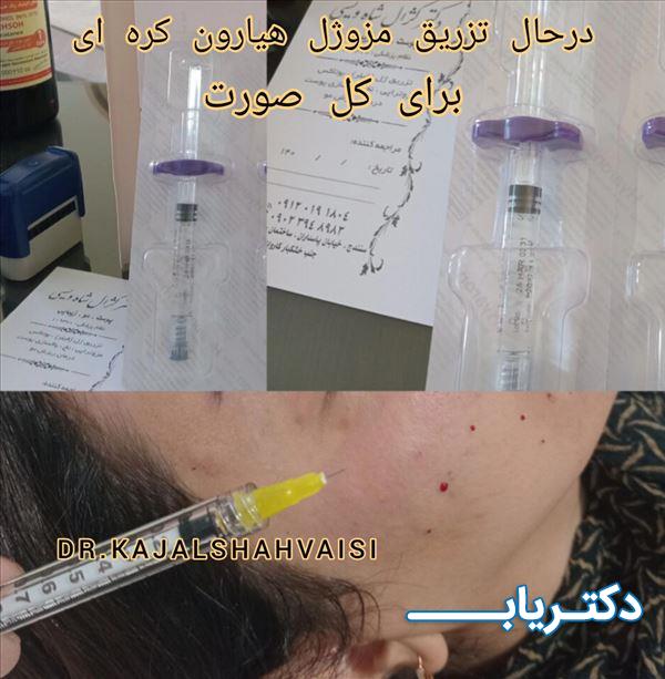 نمونه کار دکتر کژال شاه ویسی