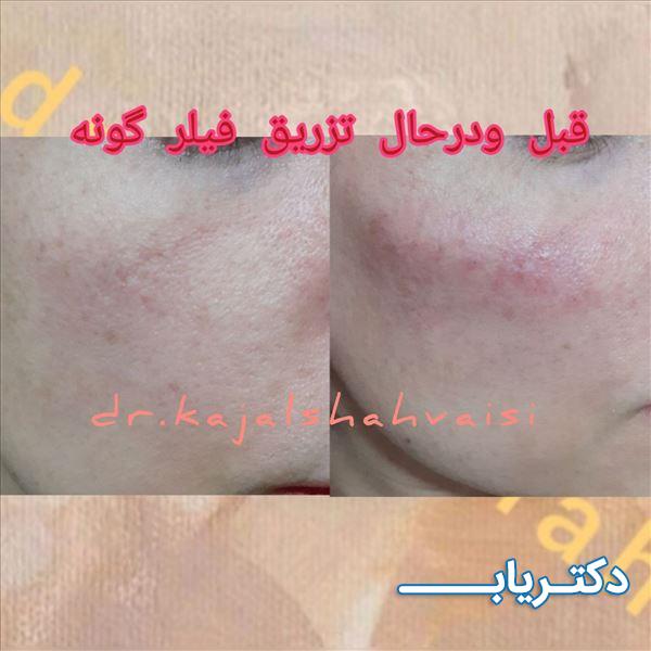 نمونه کار دکتر کژال شاه ویسی