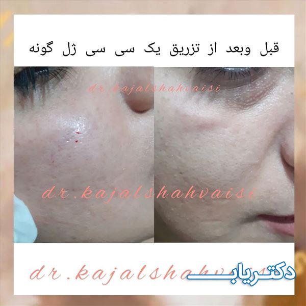 نمونه کار دکتر کژال شاه ویسی