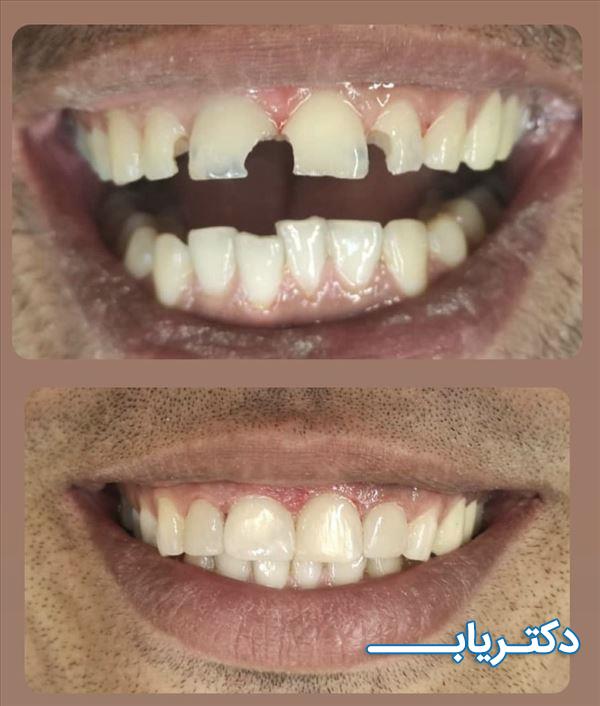 نمونه کار دکتر مهدی کتیرائی