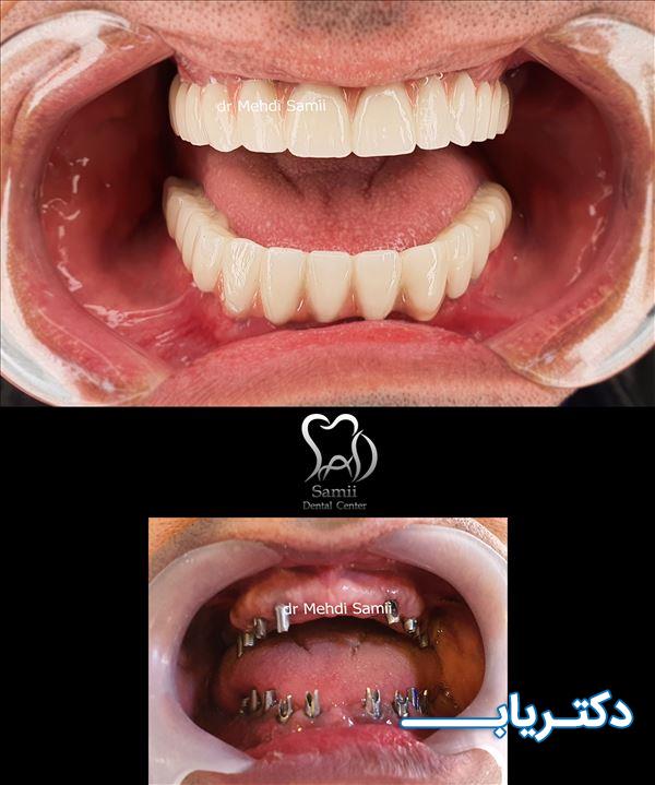 نمونه کار دکتر مهدی سمیعی 3