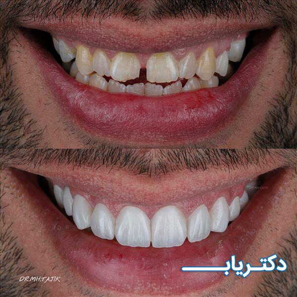 نمونه کار دکتر محمدحسین تاجیک