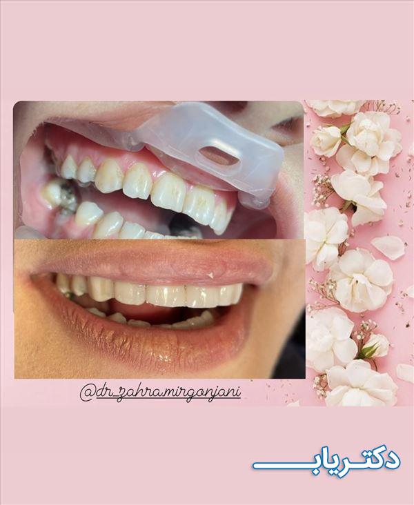 نمونه کار دکتر زهرا میرگنجانی 2
