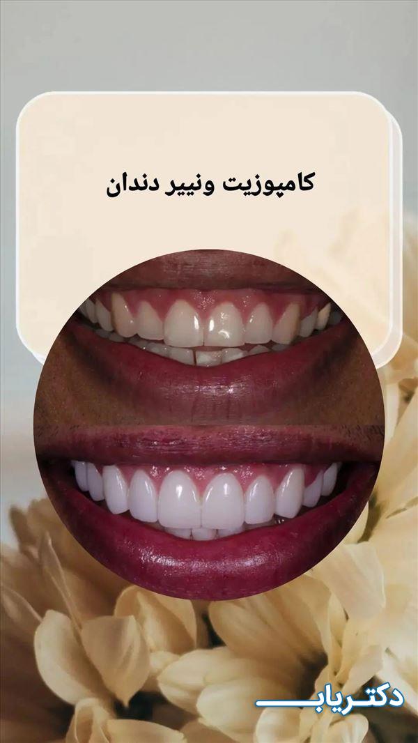 نمونه کار دکتر میترا محمدزاده 5