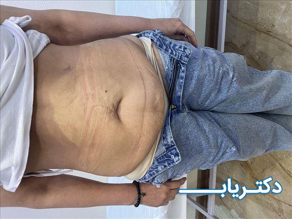 نمونه کار دکتر روح اله محقق نسب 1