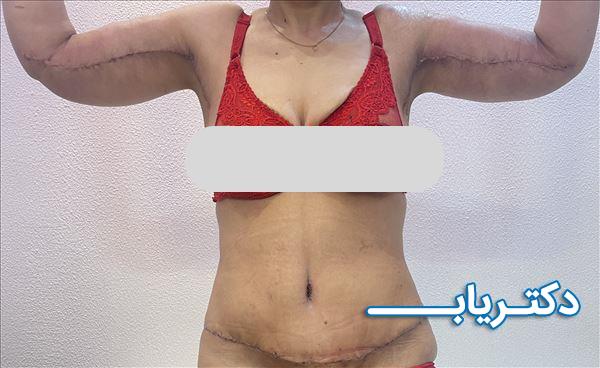 نمونه کار دکتر روح اله محقق نسب 2