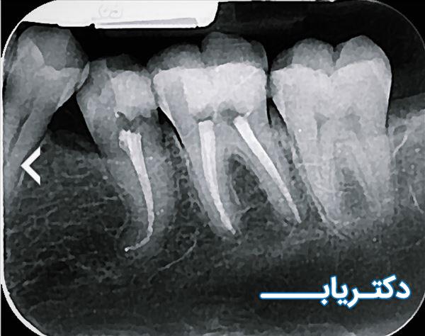 نمونه کار دکتر زینب موثق