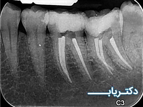 نمونه کار دکتر زینب موثق