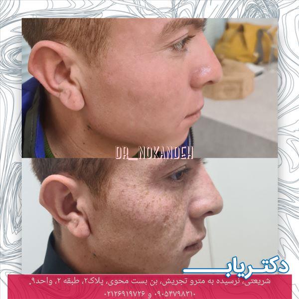 نمونه کار دکتر مریم نوکنده 1