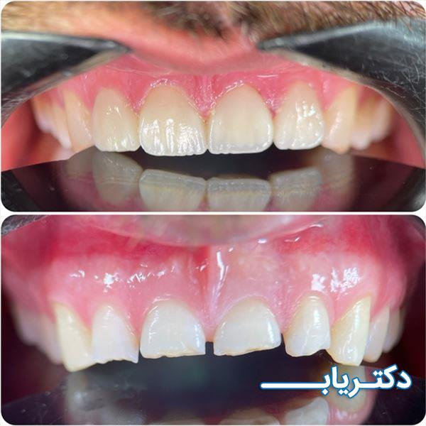 نمونه کار دکتر پدرام عبداله زاده 3