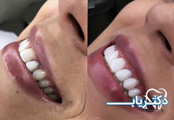 نمونه کار دکتر دنیا رشنو 4