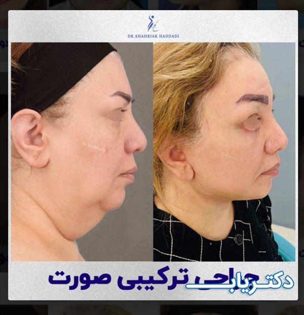 نمونه کار دکتر شهریار حدادی