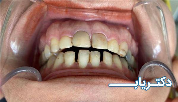 نمونه کار دکتر علی شالچی زاده مرندی