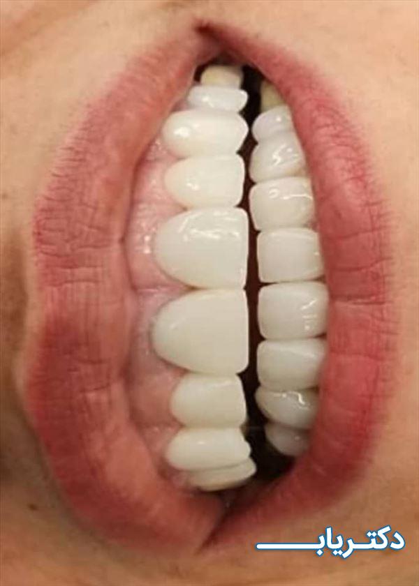نمونه کار دکتر علی شالچی زاده مرندی