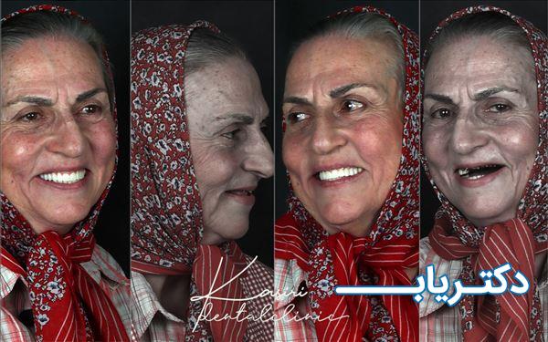 نمونه کار دکتر ویدا پاکدل 3