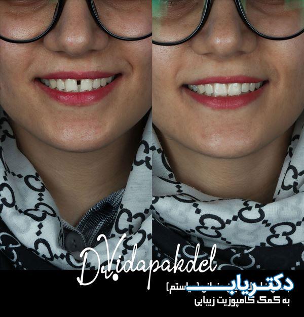 نمونه کار دکتر ویدا پاکدل 5