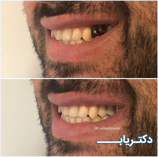 نمونه کار دکتر زینب ایمانی 1
