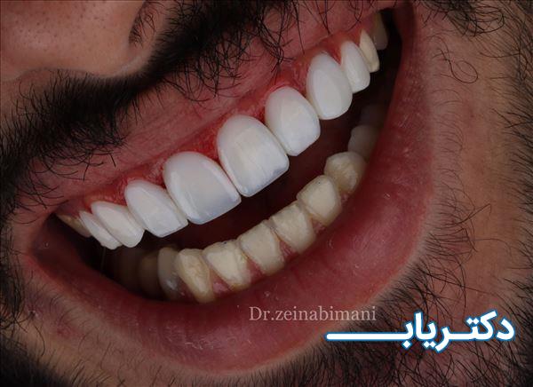 نمونه کار دکتر زینب ایمانی 2
