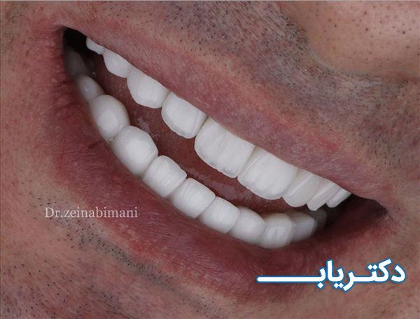 نمونه کار دکتر زینب ایمانی 4