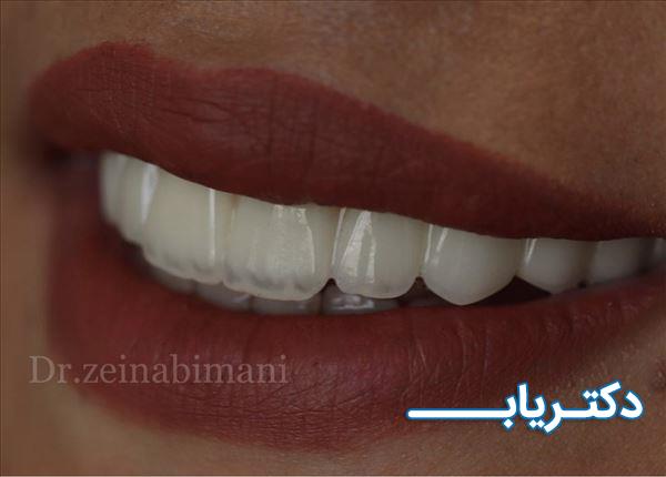 نمونه کار دکتر زینب ایمانی 5