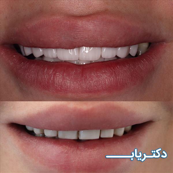 نمونه کار دکتر احسان صادقی 2