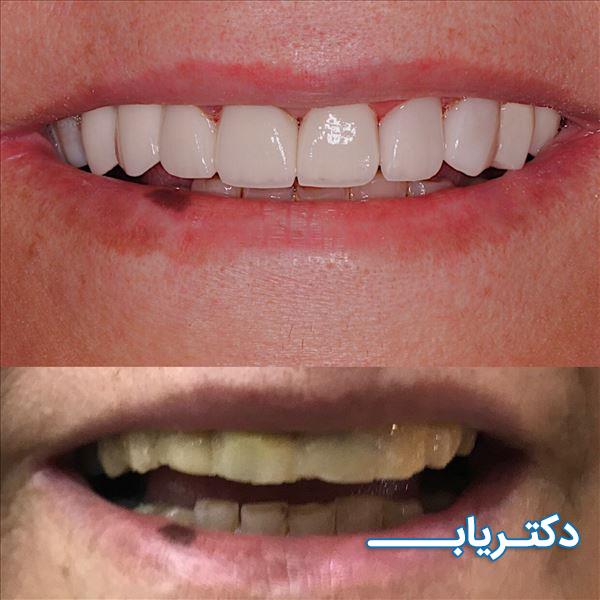 نمونه کار دکتر احسان صادقی 3