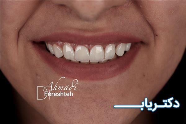 نمونه کار دکتر فرشته احمدی