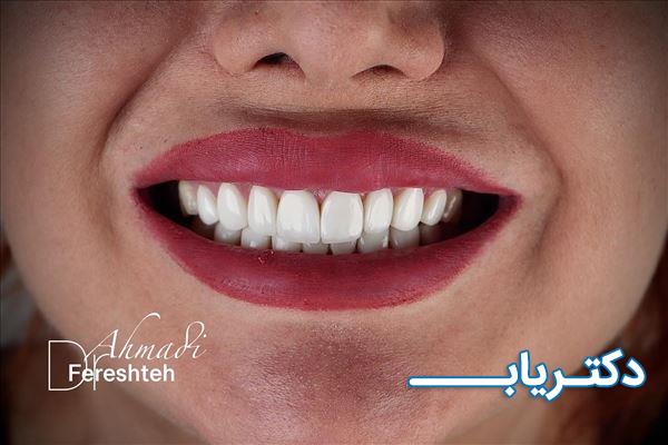 نمونه کار دکتر فرشته احمدی