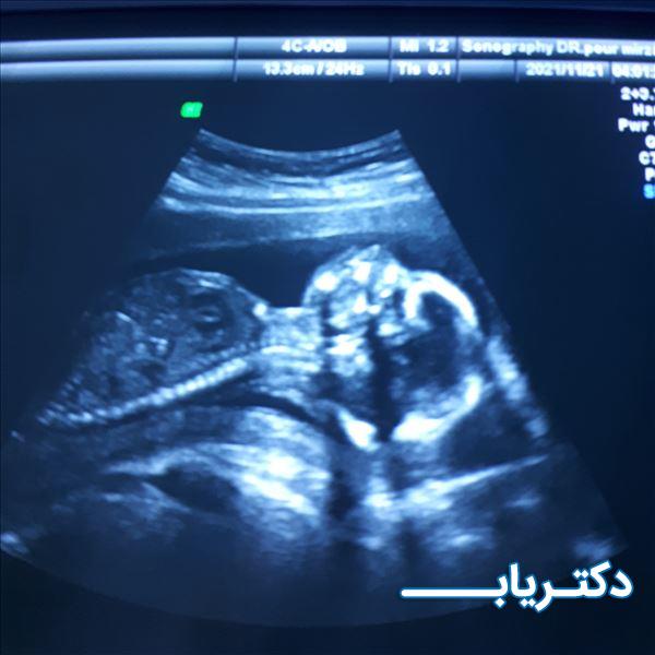نمونه کار دکتر فرانک پورمیرزا 1