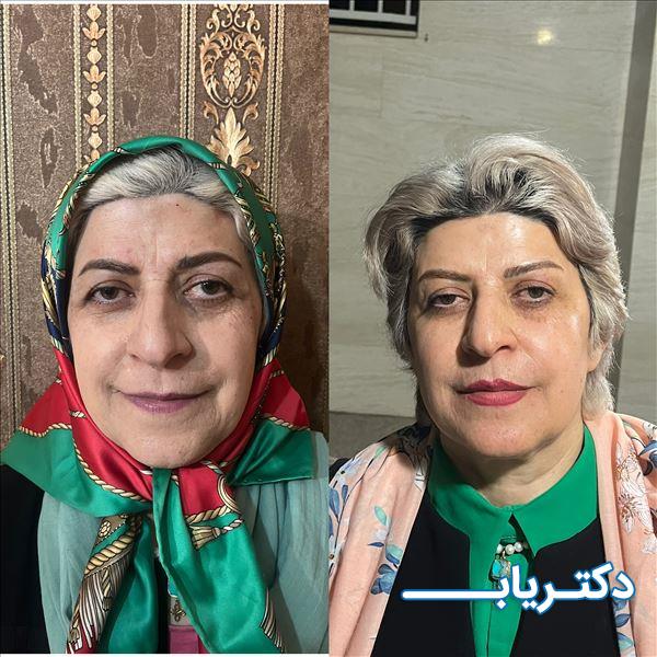 نمونه کار دکتر فرخنده رهنما