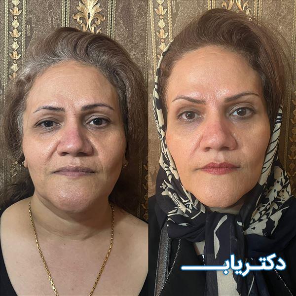 نمونه کار دکتر فرخنده رهنما