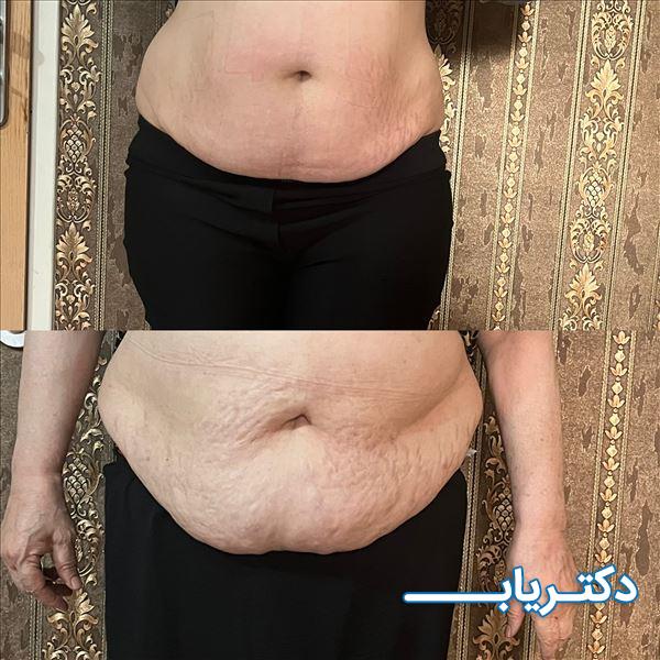 نمونه کار دکتر فرخنده رهنما