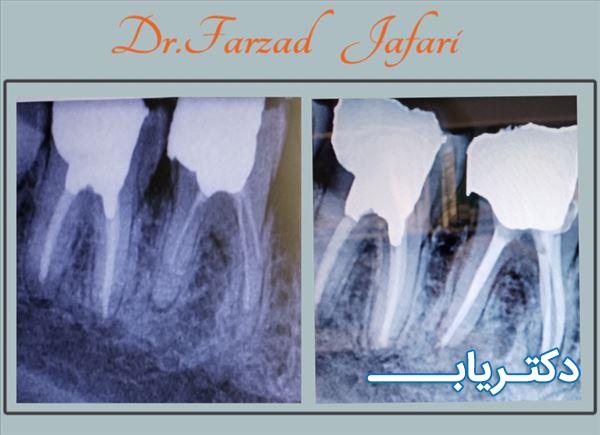 نمونه کار دکتر فرزاد جعفری