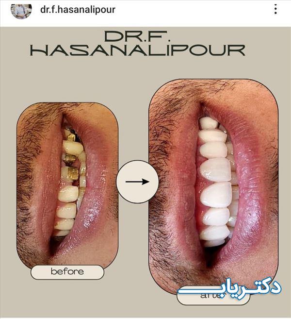 نمونه کار دکتر فاطمه حسنعلی پور 4