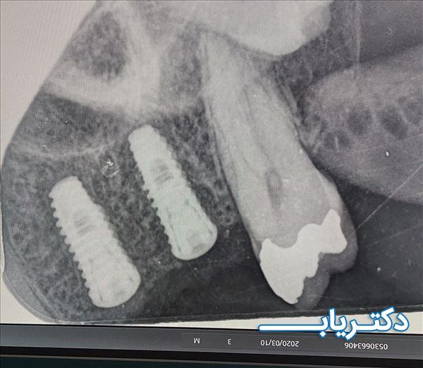 نمونه کار دکتر فاطمه تشکر 4