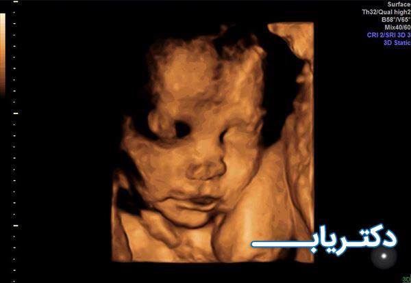 نمونه کار دکتر انوشه فاضل پور 1