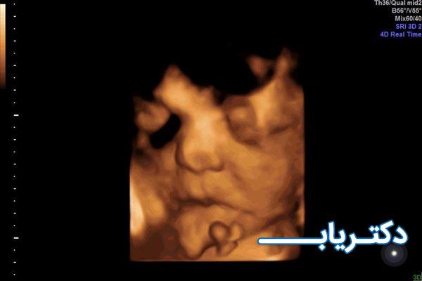 نمونه کار دکتر انوشه فاضل پور 2
