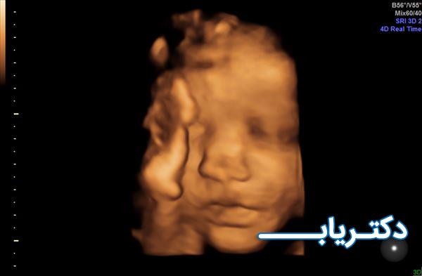 نمونه کار دکتر انوشه فاضل پور 3