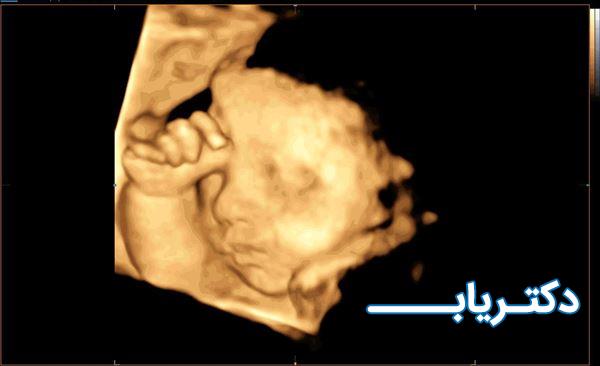 نمونه کار دکتر انوشه فاضل پور 4