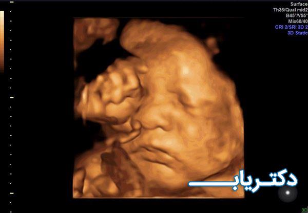 نمونه کار دکتر انوشه فاضل پور 5