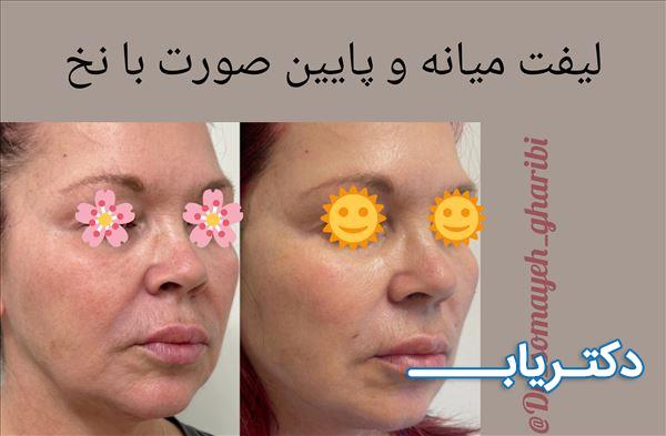 نمونه کار دکتر سمیه غریبی