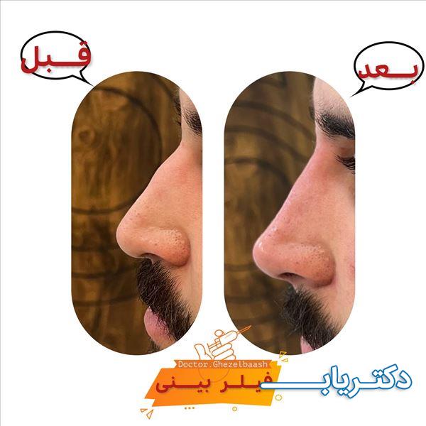 نمونه کار دکتر سعید قزلباش