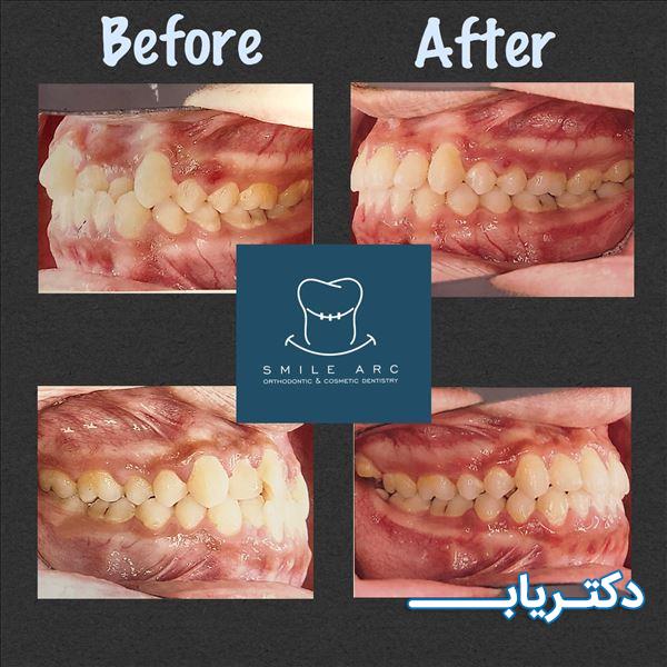 نمونه کار دکتر حمید گلشاهی 4