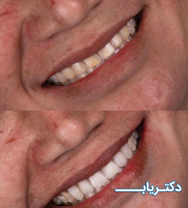 نمونه کار دکتر حنانه خدادادی